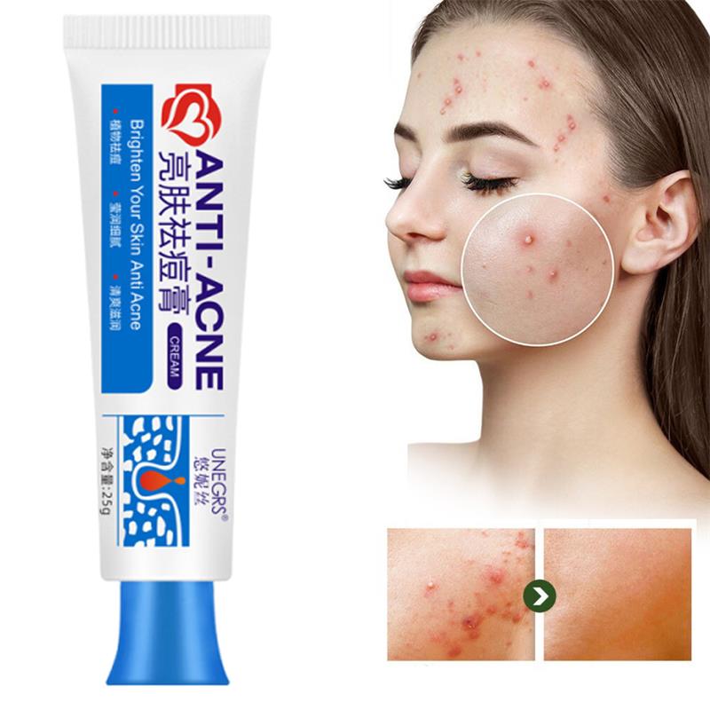 Skincare Herbal - Bitkisel Sivilce Giderici Yüz Kremi Sivilce