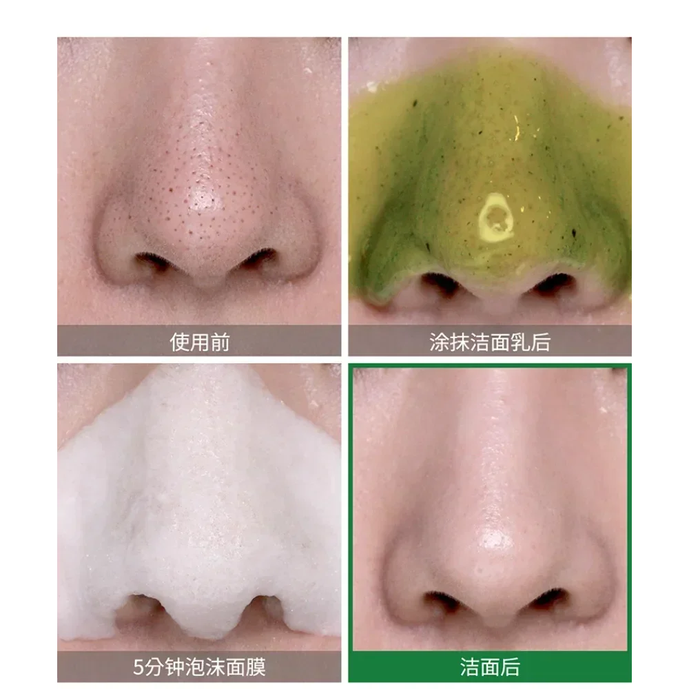 Kore SOME BY MI Bye Bye Siyah  - Skincare Some By Mi incelemesi ve fiyatı