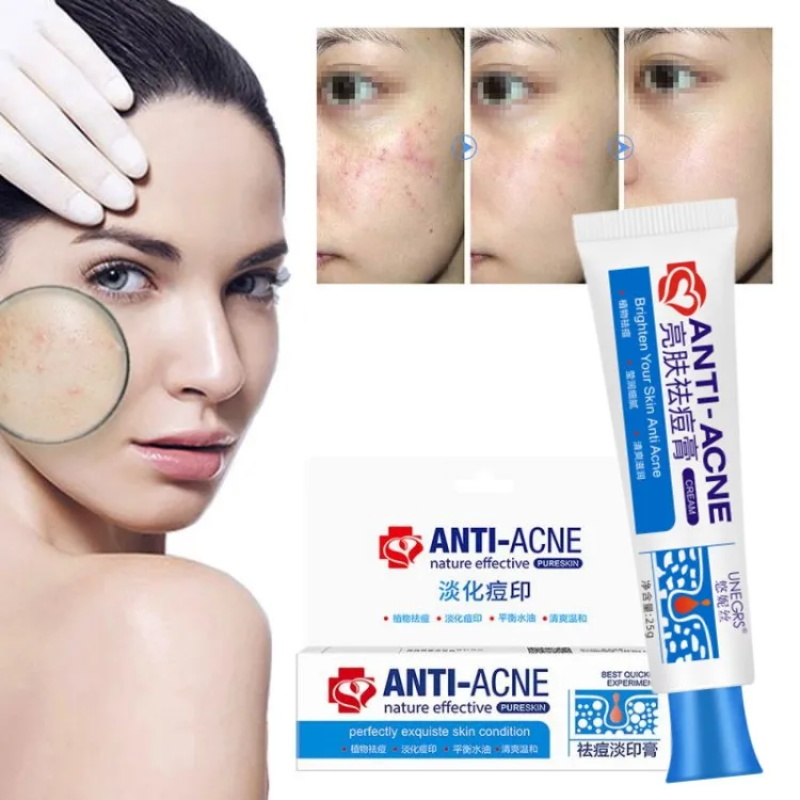 Bitkisel Sivilce Giderici Yüz  - Skincare Herbal incelemesi ve fiyatı
